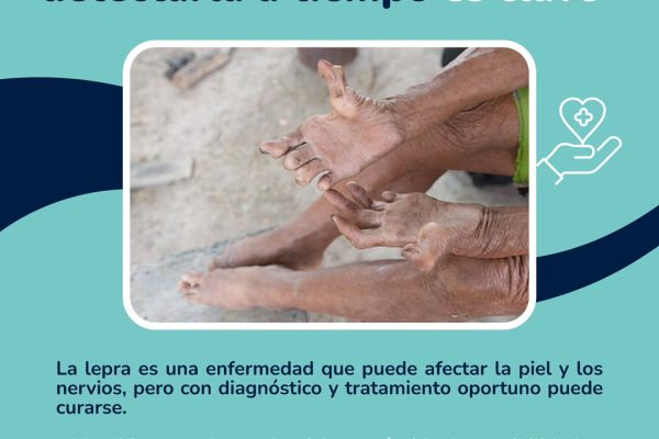 La Lepra tiene cura, detectarla a tiempo es la clave